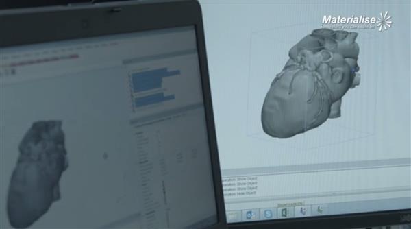 Materialise CEOPע3DӡtI