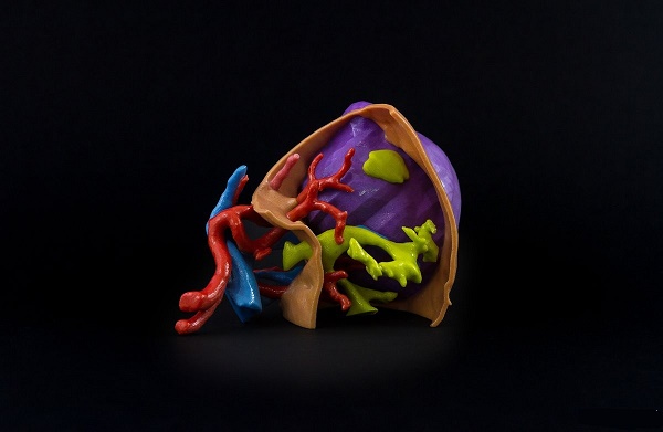 深耕肺病治療,Materialise 向肺部成像公司Fluidda 投資250萬歐元 深耕肺病治療,Materialise 向肺部成像公司Fluidda 投資250萬歐元