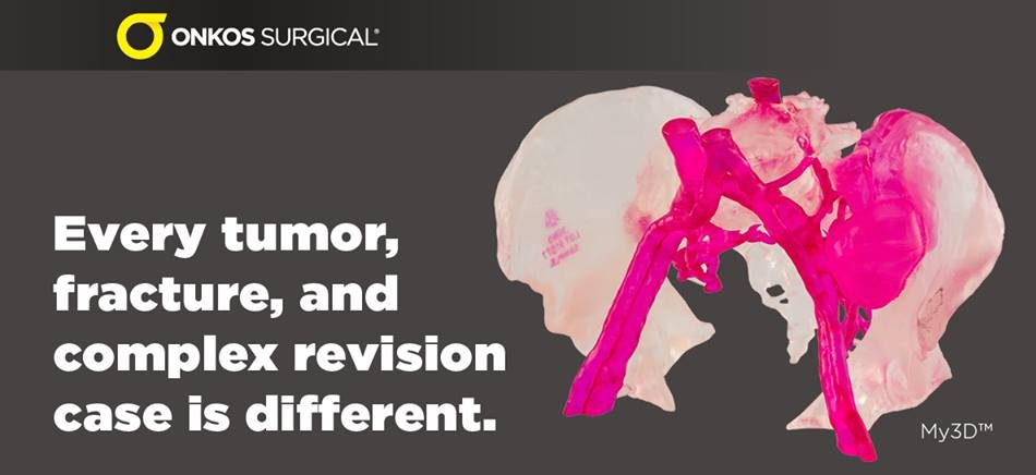 Onkos Surgical My3D™個(gè)性化解決方案平臺(tái) Onkos Surgical My3D™個(gè)性化解決方案平臺(tái)